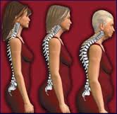 Osteoporosis Prevention & Awareness